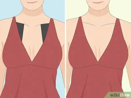 Image titled Tape Your Boobs for a Backless Dress Step 10