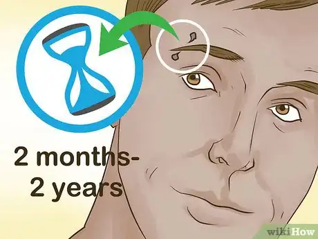 Image titled Avoid Eyebrow Piercing Scars Step 11