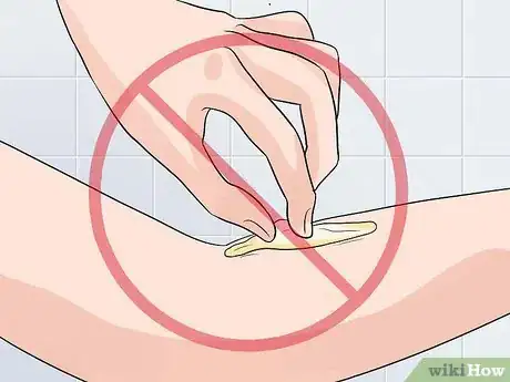 Image titled Remove Keloid Scars at Home Step 3