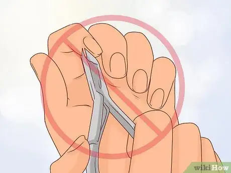 Image titled Stop Biting Your Cuticles Step 13