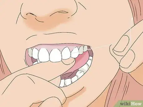 Image titled Relieve Tooth Abscess Pain Step 4