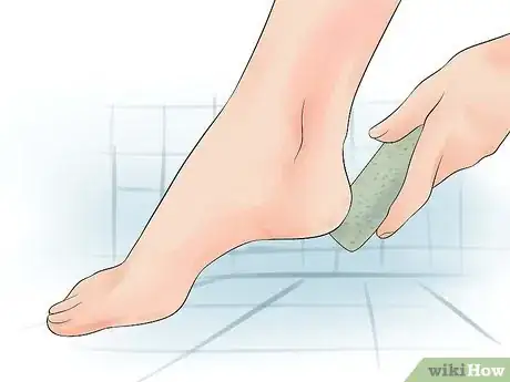 Image titled Prevent Smelly Feet Step 2