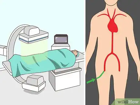Image titled Diagnose Vasculitis Step 15