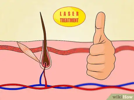 Image titled Get the Most Benefit from Laser Hair Removal Step 1