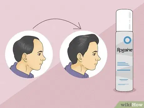 Image titled Prevent Hair Loss Step 9