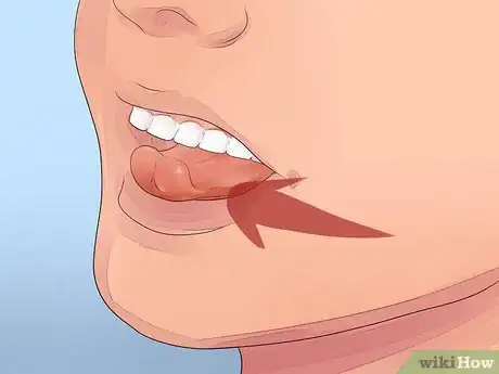 Image titled Make a Loose Tooth Fall Out Without Pulling It Step 3