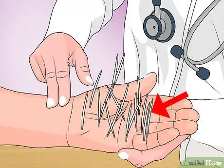 Image titled Remove Porcupine Quills Step 14