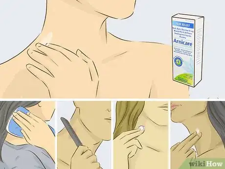 Image titled Give Someone a Hickey Step 15