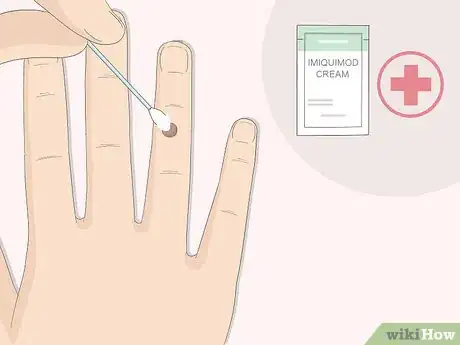 Image titled Get Rid of Warts Step 10