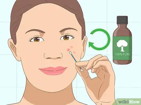 Image titled Use Tea Tree Oil for Acne Step 7