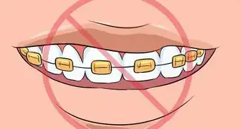 Choose the Color of Your Braces