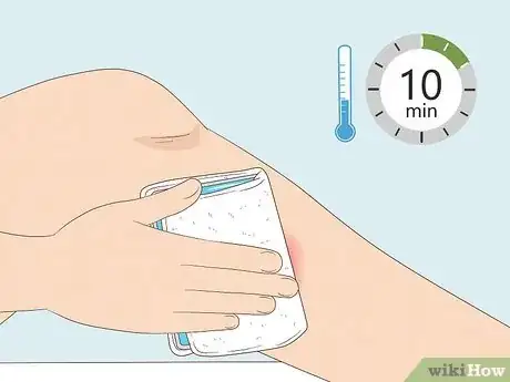 Image titled Get Rid of Bruises with Toothpaste Step 8
