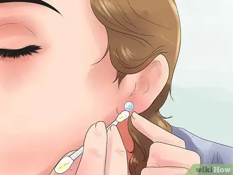 Image titled Take Care of Pierced Ears Step 7