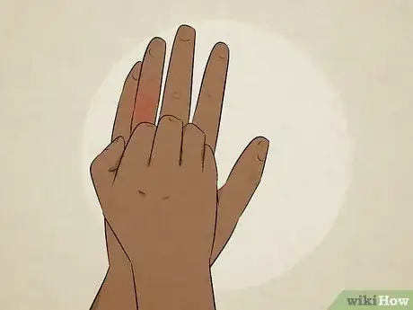 Image titled What Does It Mean when Your Left Hand Itches Step 6