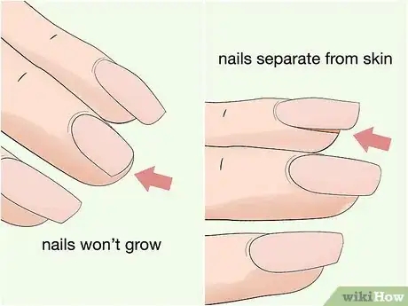 Image titled Strengthen Weak Fingernails Naturally Step 17