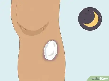 Image titled Get Rid of Bruises with Toothpaste Step 4