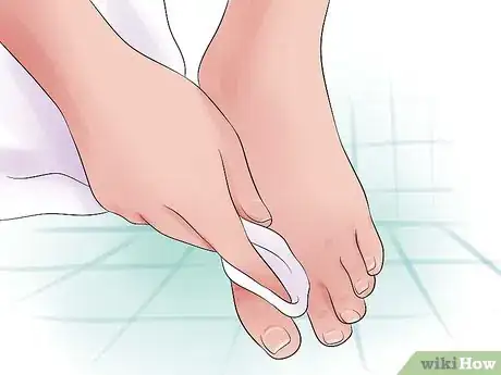 Image titled Prevent Smelly Feet Step 3