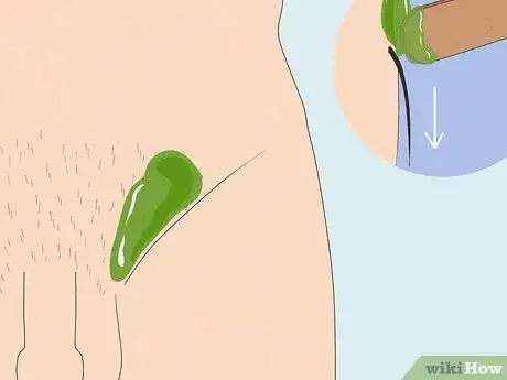 Image titled Remove Male Pubic Hair Without Shaving Step 17