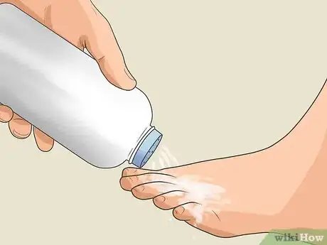 Image titled Prevent Foot Odor Step 8