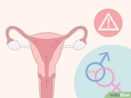 Image titled Identify Abnormal Vaginal Spotting Between Periods Step 10