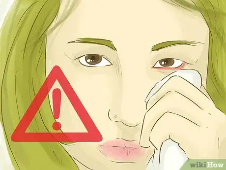 Image titled Use Eye Drops Step 17