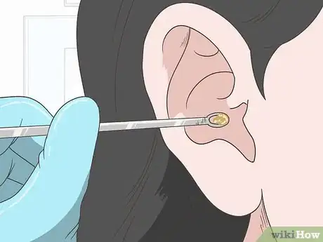 Image titled Unclog Your Ears After a Cold Step 9