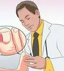 Cure an Infected Toe
