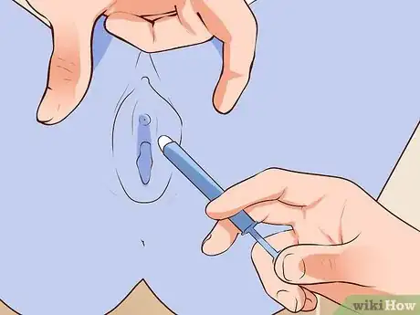 Image titled Insert Vaginal Suppositories Step 4