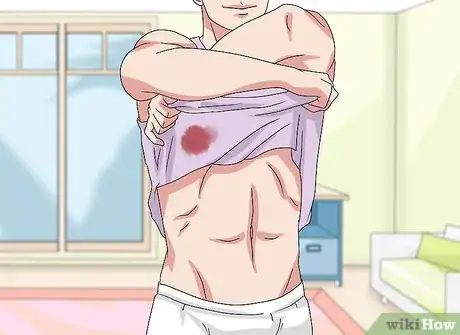 Image titled Remove Tomato Stains Step 1