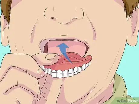 Image titled Apply Denture Adhesive Step 10