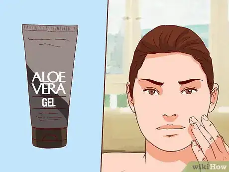 Image titled Get Rid of Pimples with Aloe Vera Gel Step 4