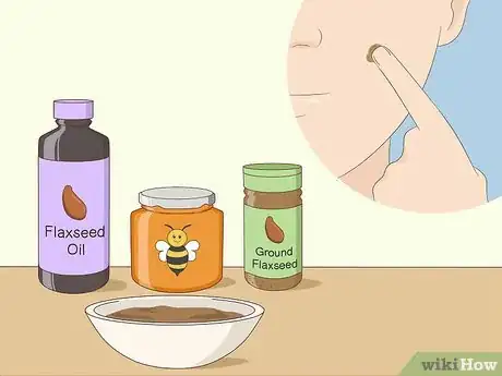 Image titled Get Rid of Moles on Your Face Step 15