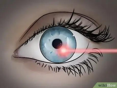 Image titled Get Rid of Eye Floaters Step 12