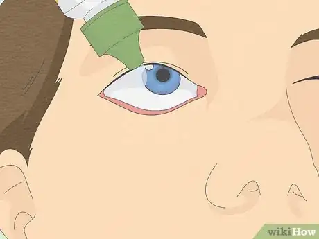 Image titled Can You Put Contacts in Water Step 8
