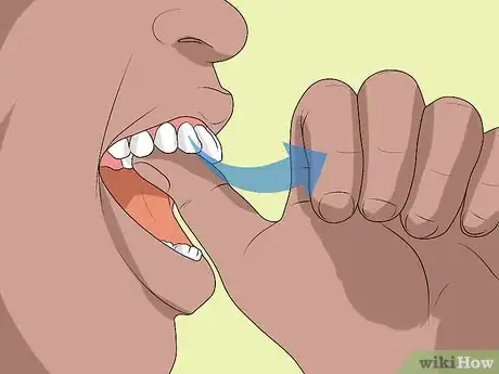 Image titled Apply Denture Adhesive Step 14