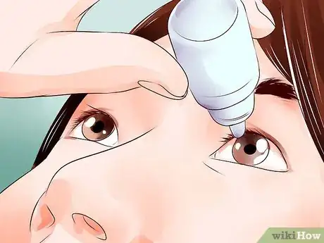 Image titled Soothe Sore Eyes Step 1