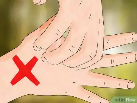 Image titled Get Rid of Bug Bites Step 2