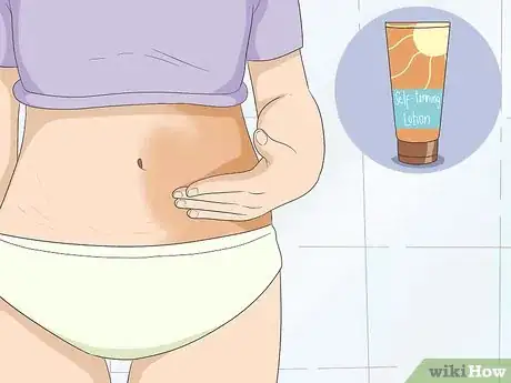 Image titled Get Rid of Stretch Marks at Home Step 2