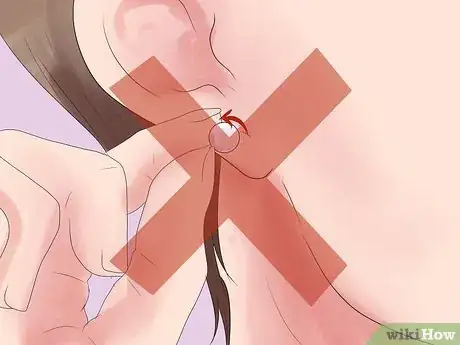 Image titled Take Care of Pierced Ears Step 3