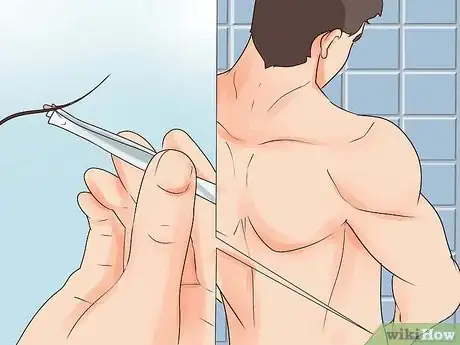 Image titled Get Rid of Pubic Lice Step 6