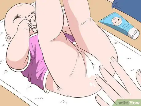Image titled Identify and Treat Different Types of Diaper Rash Step 11