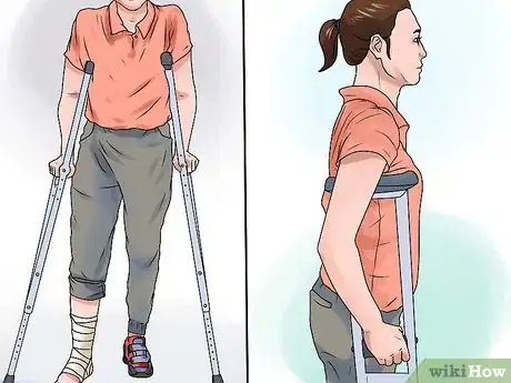 Image titled Walk on Crutches Step 2
