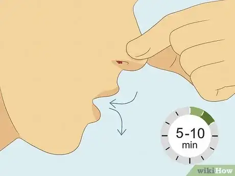 Image titled Stop a Nosebleed with a Penny Step 5