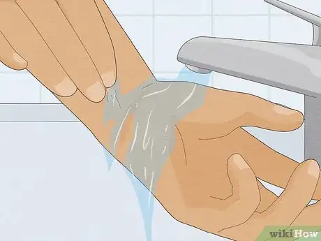 Image titled Remove Super Glue from Your Skin (Petroleum Jelly Method) Step 5