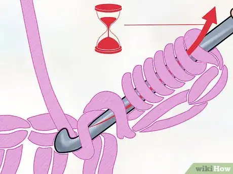 Image titled Crochet the Bullion Stitch Step 9