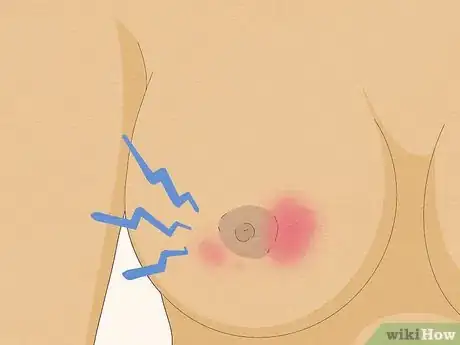 Image titled Avoid Sore Nipples While Breast Feeding Step 16