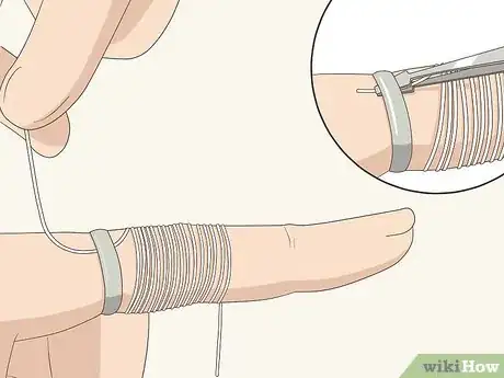 Image titled Remove a Ring in an Emergency Step 9