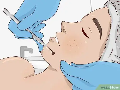 Image titled Get Rid of Blackheads Naturally Step 17