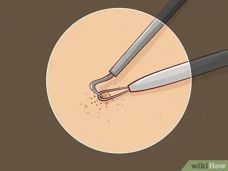 Imagen titulada Close Blackhead Holes Step 12