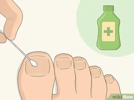 Imagen titulada Give Yourself a Pedicure Using Salon Techniques Step 14